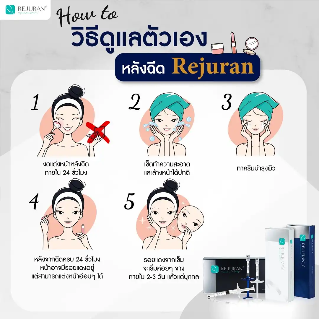 วิธีดูแลตัวเองหลังฉีด Rejuran 5 ขั้นตอนง่ายๆ