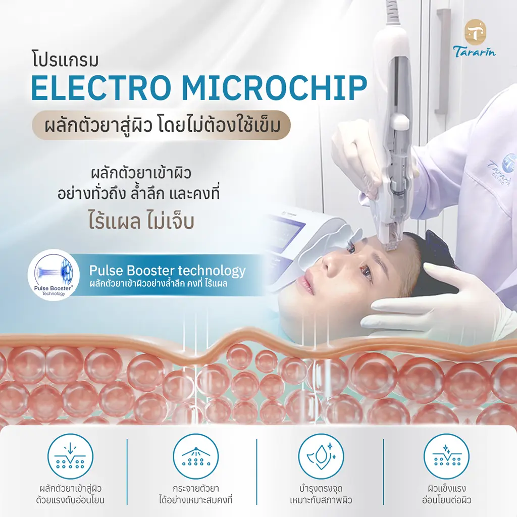 Electro Microchip Pulse Booster EPM เทคโนโลยีผลักสารบำรุงเข้าสู่ผิว
