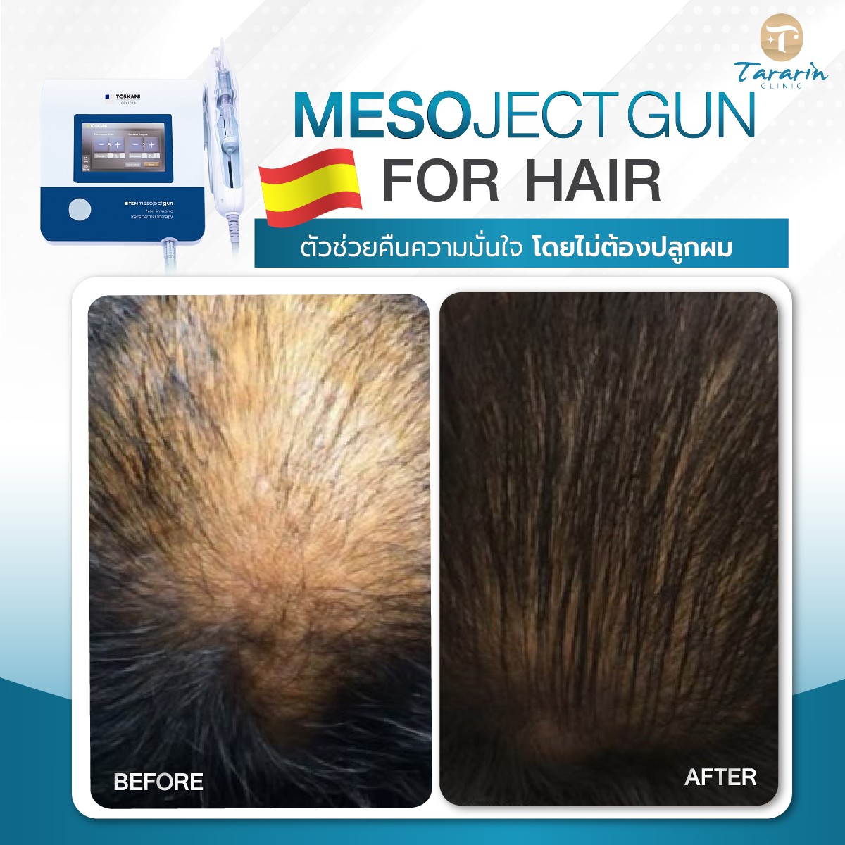 Electro Microchip Toskani Hair Cocktail ดูแลหนังศีรษะและเส้นผม