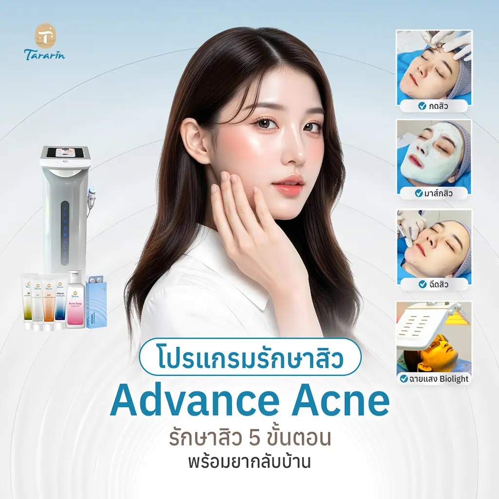 Advance-Acne