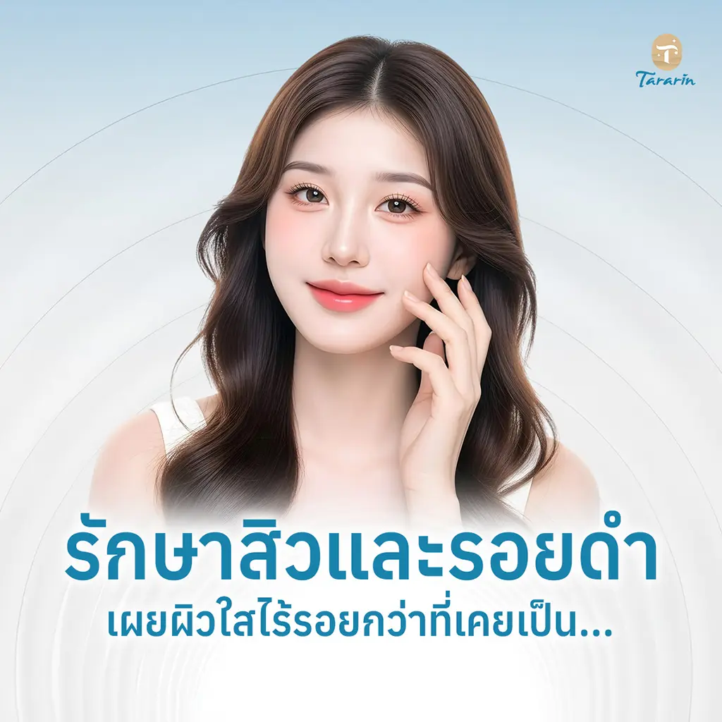 รักษาสิวและรอยดำ เลือกแนวทางดูแลผิวให้เหมาะกับปัญหา