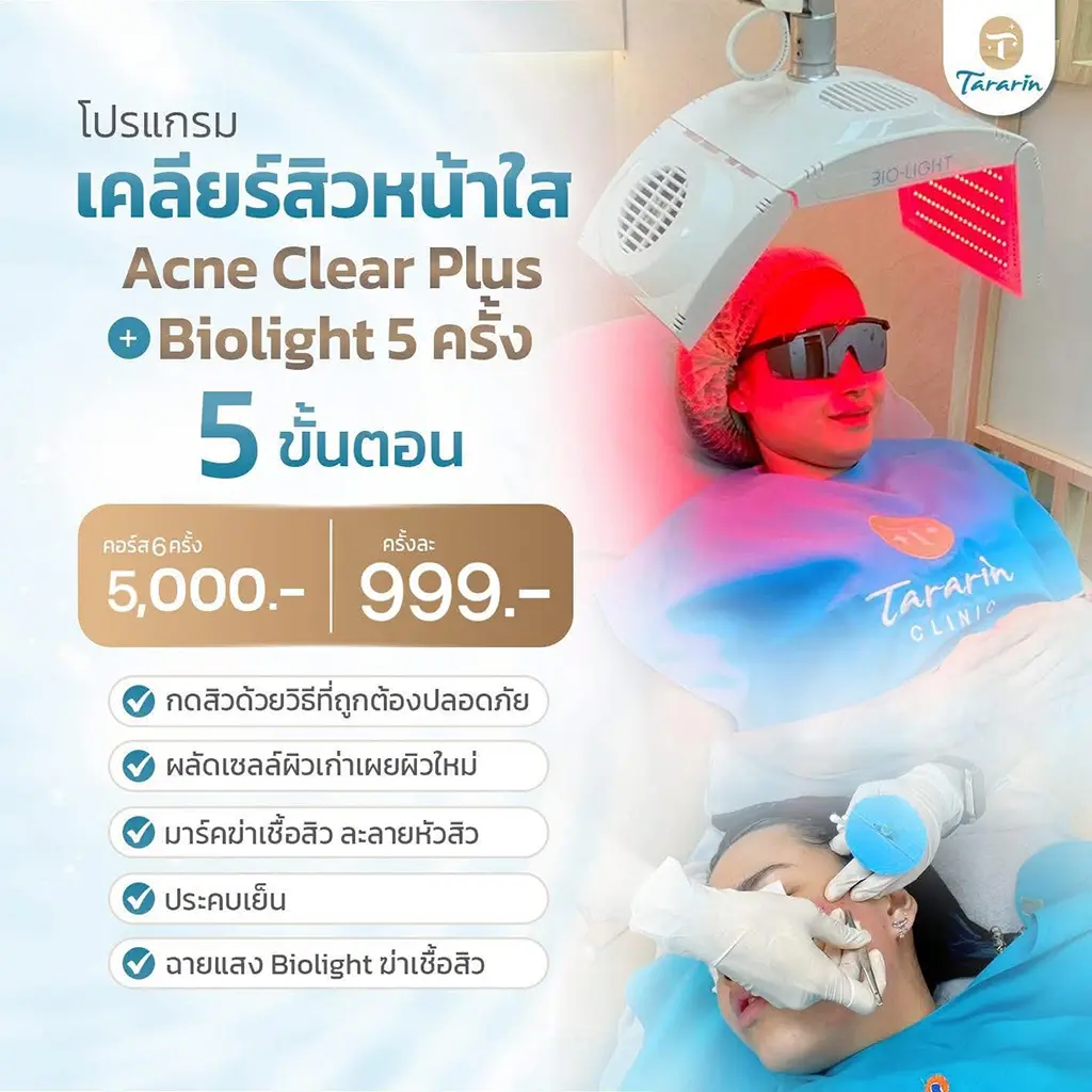 acne-clear-plus-biolight