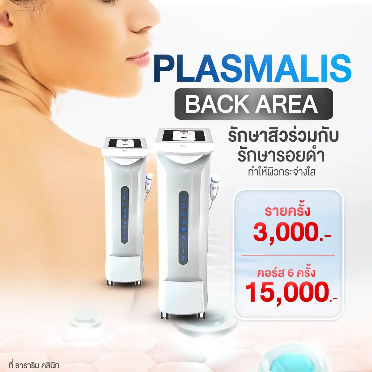 Plasma Back area รักษาสิวที่หลัง รักษารอยดำ Plasmalis