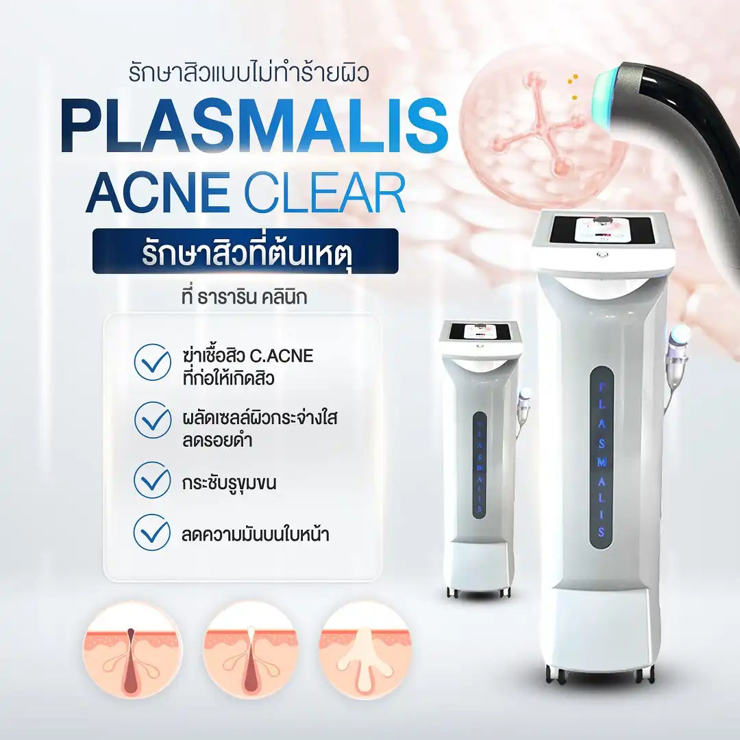 Plasmalis ขจัดปัญหาสิว รักษาสิว ที่ต้นเหตุด้วยเทคโนโลยีพลาสม่า
