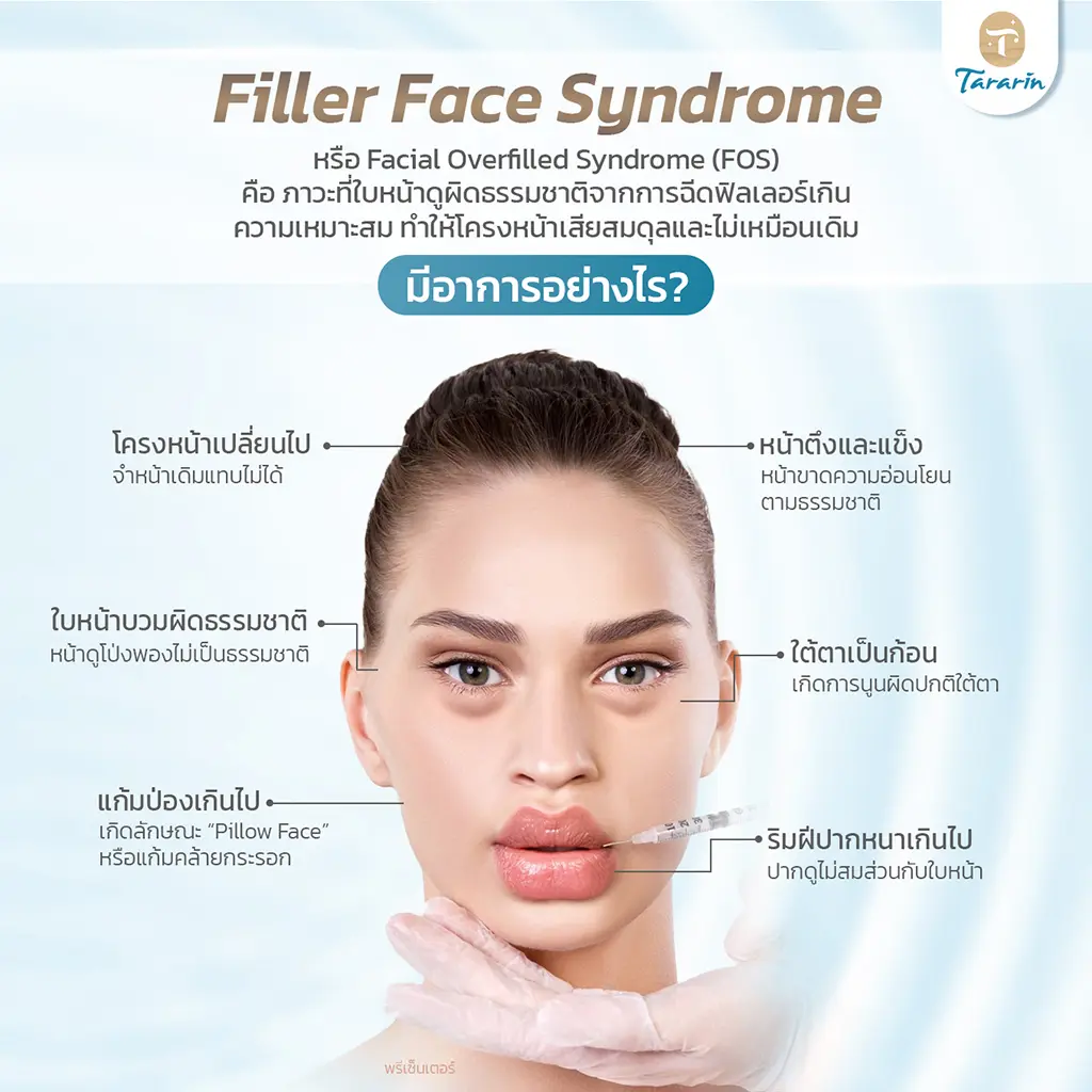 Filler Face Syndrome หรือ Facial Overfilled Syndrome คืออะไร