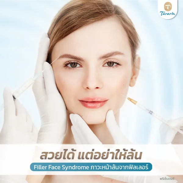 "Filler Face Syndrome" ภาวะหน้าล้นจากฟิลเลอร์