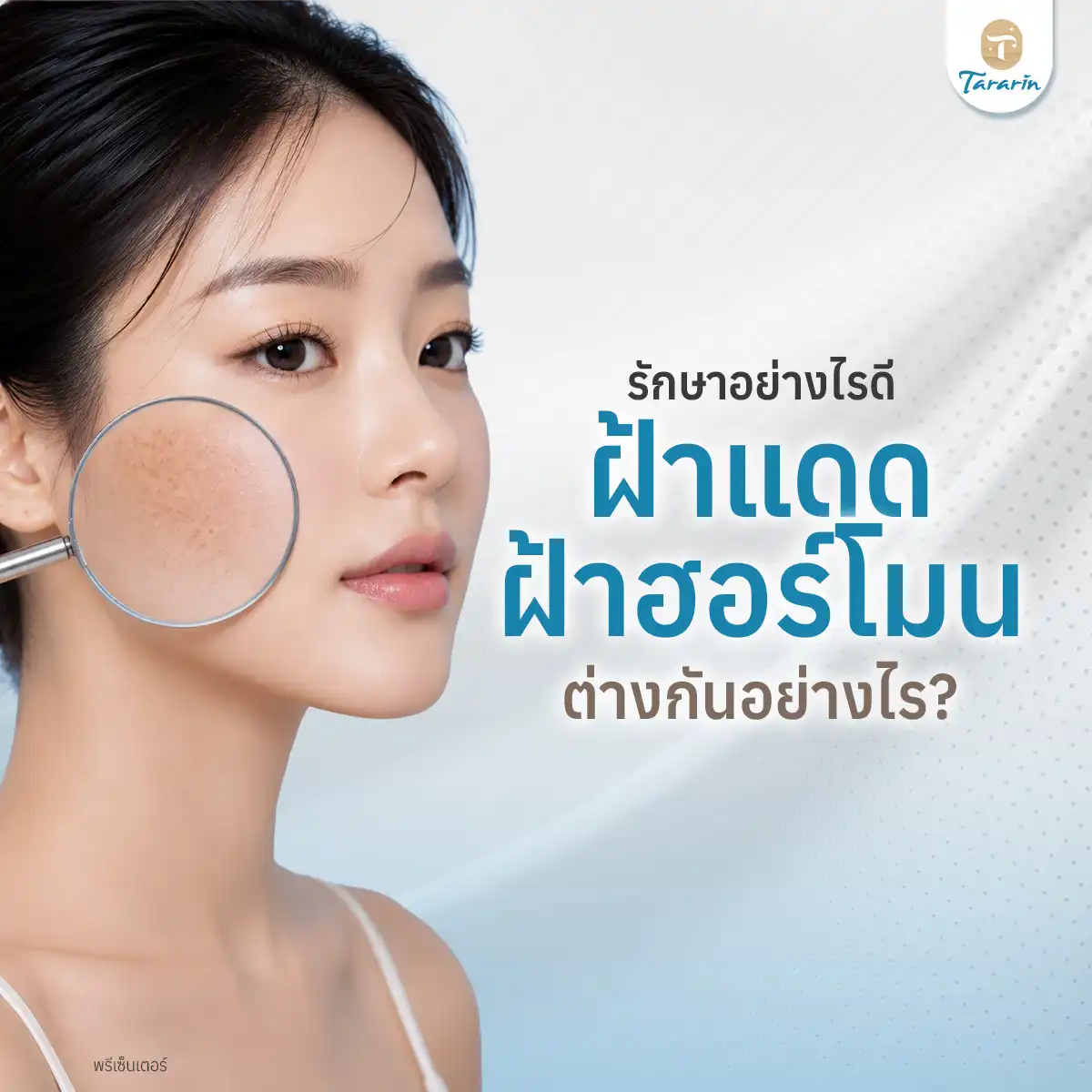 ฝ้าแดด หรือ ฝ้าฮอร์โมน? รู้จักประเภทฝ้าก่อนเริ่มรักษา