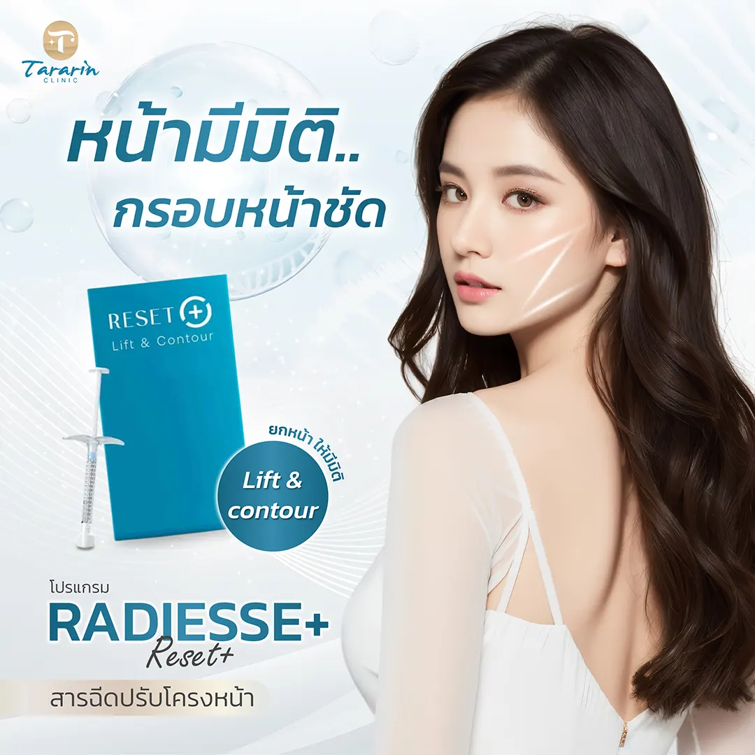ผลลัพธ์การฉีด Radiesse Plus ยกกระชับโครงหน้า กรอบหน้าชัด ใบหน้าคมมีมิติ
