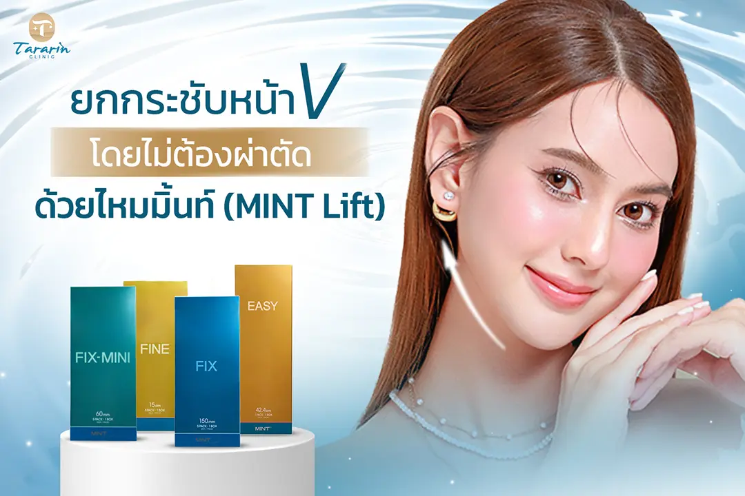 การร้อยไหม Thread Lift ยกกระชับใบหน้าไม่ผ่าตัด