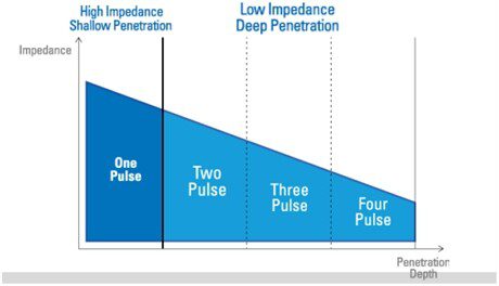 Multi-Pulse ช่วยปกป้องผิวหนังชั้นบนขณะรักษา
