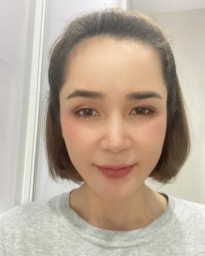 หลังทำการปรับรูปหน้าแบบองค์รวม