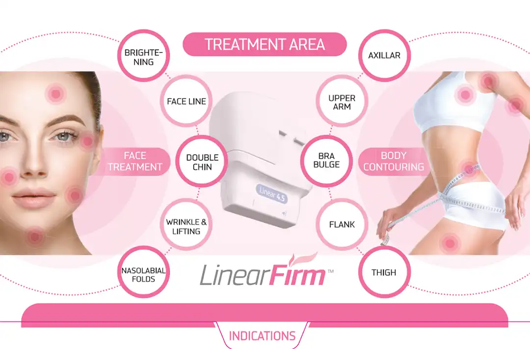 Linear HIFU ยกคิ้ว ริ้วรอยรอบดวงตา ปรับหน้าเรียว