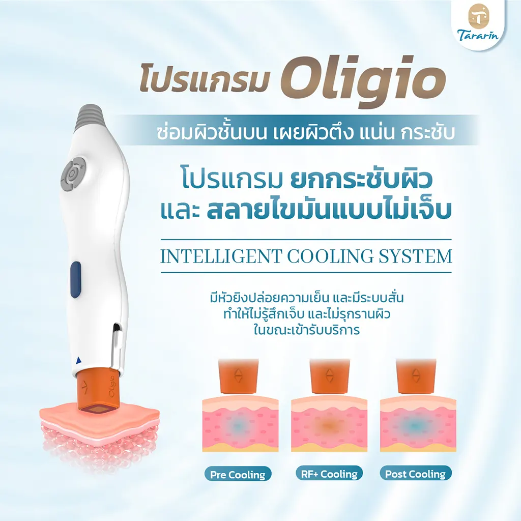 Oligio คืออะไร เทคโนโลยี RF ยกกระชับผิว