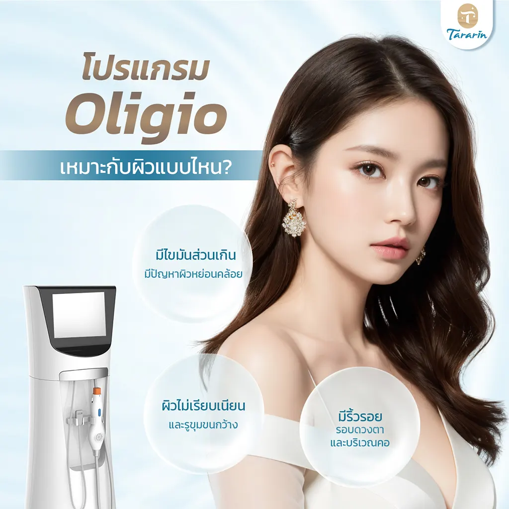 Oligio เหมาะกับผู้ที่ต้องการยกกระชับโดยไม่ผ่าตัด