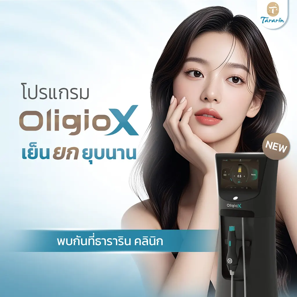 OligioX เทคโนโลยียกกระชับใบหน้าในขอนแก่น เพื่อผิวที่ดูเรียบเนียนอย่างเป็นธรรมชาติ