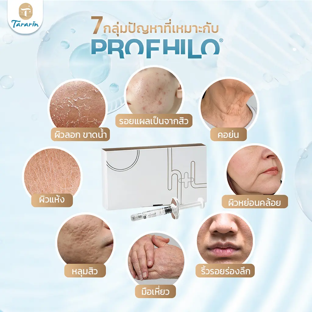Profhilo เหมาะกับผู้ที่ผิวหย่อนคล้อย ผิวแห้ง ต้องการเพิ่มความยืดหยุ่น