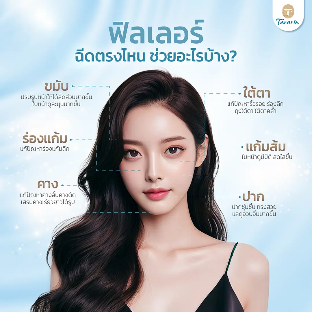 ผลลัพธ์ที่ได้จากฟิลเลอร์ เห็นผลทันที ใบหน้าเต็มอิ่ม สดใส ดูเด็กลง อยู่ได้ 6 เดือน ถึง 1 ปี