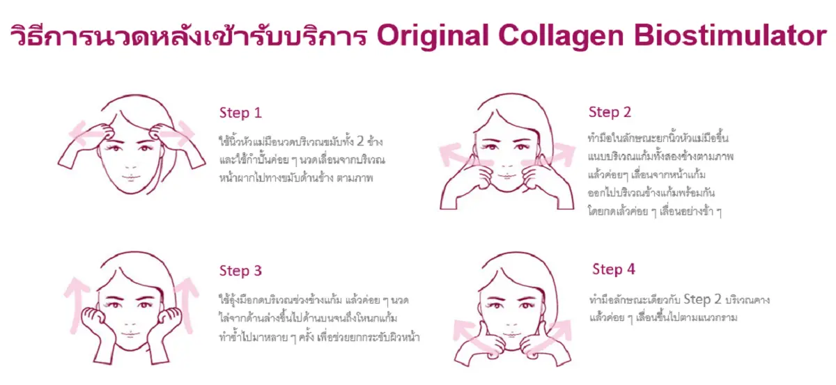 Sculptra วิธีนวด Triple5 Step 1-4 กระจาย PLLA ยกกระชับใบหน้า