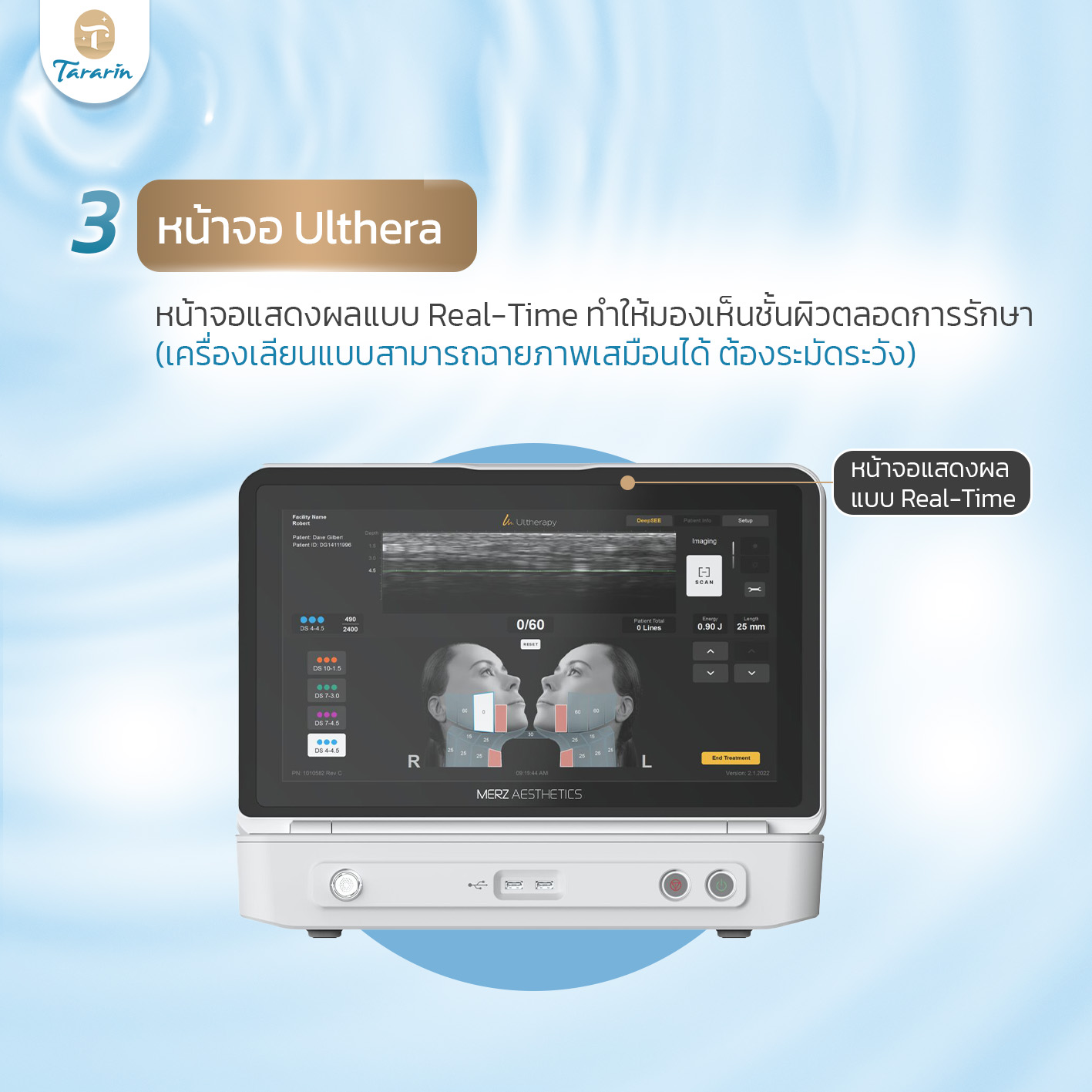 ตรวจสอบเครื่อง Ultherapy Prime แท้ merzaesthetics ธาราริน คลินิก ขึ้นทะเบียน