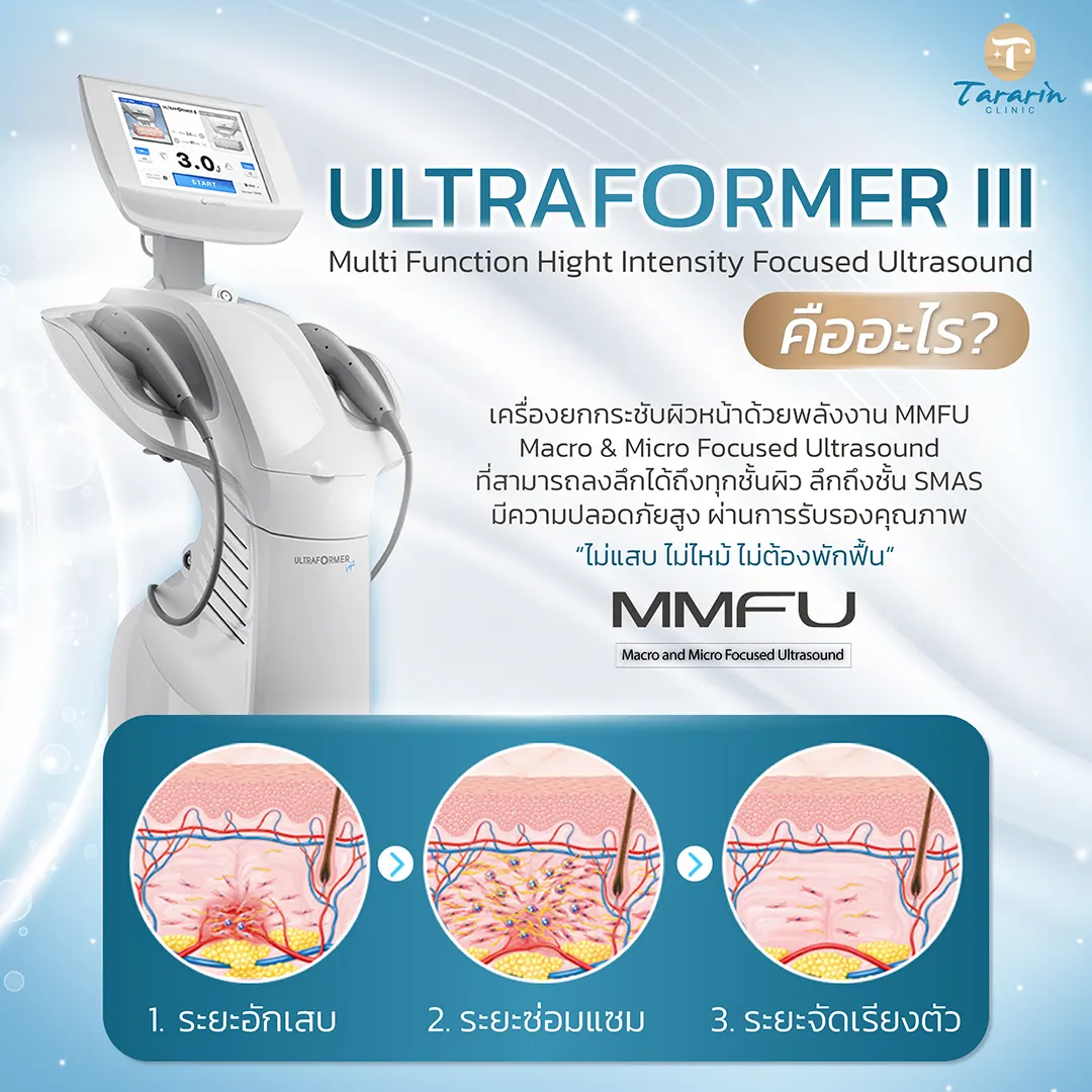 Ultraformer III เทคโนโลยียกกระชับผิวหน้า Focused Ultrasound