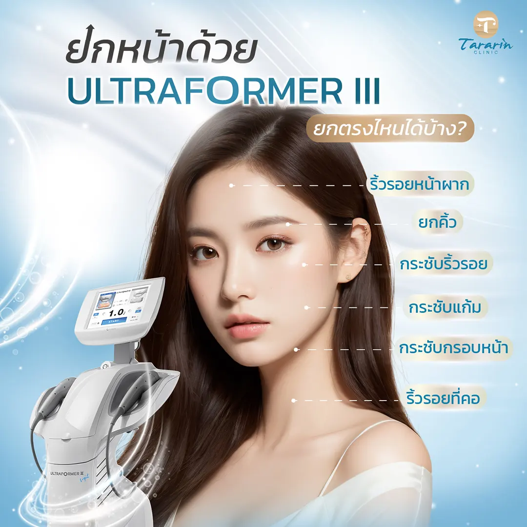 ประโยชน์ของ Ultraformer III MMFU ยกกระชับแก้ม ร่องแก้ม ใต้คาง