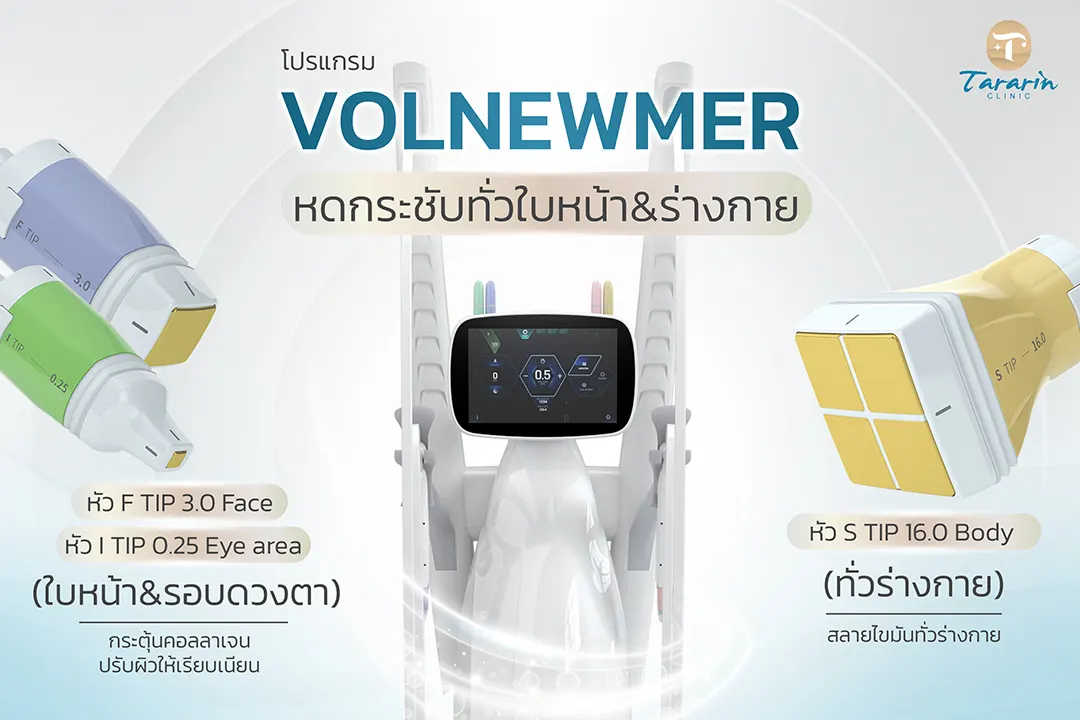 Volnewmer เทคโนโลยี Gold Continuous RF ยกกระชับผิวหน้า