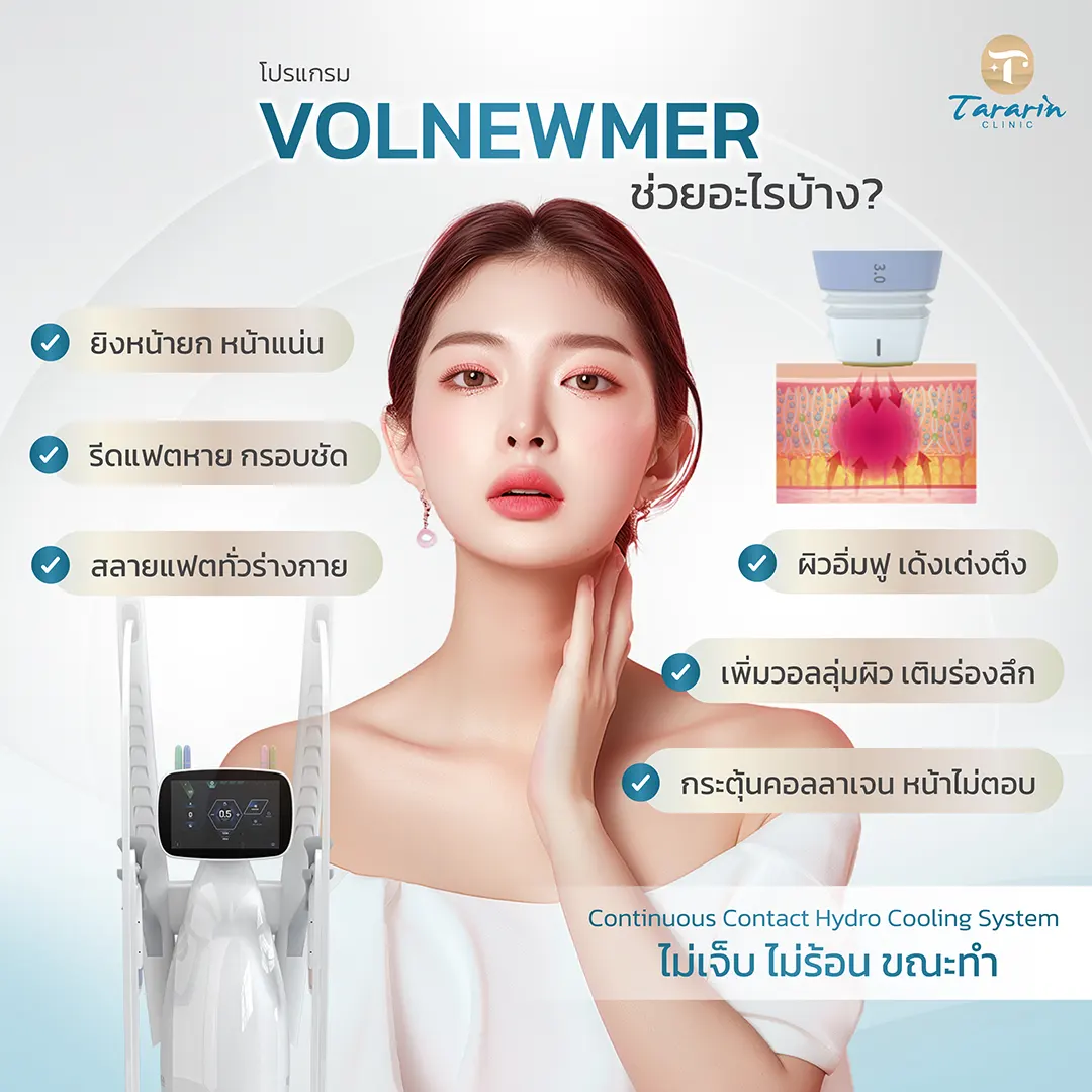 Volnewmer ผลลัพธ์ยกกระชับหน้า ผิวเด้ง กระชับแน่น ลดริ้วรอย
