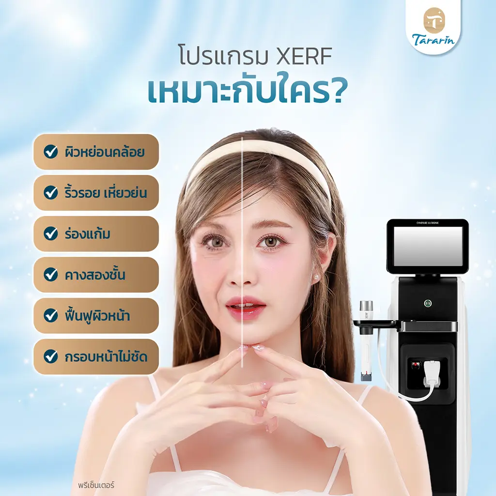 กลุ่มที่เหมาะสำหรับการทำ XERF ยกกระชับผิว