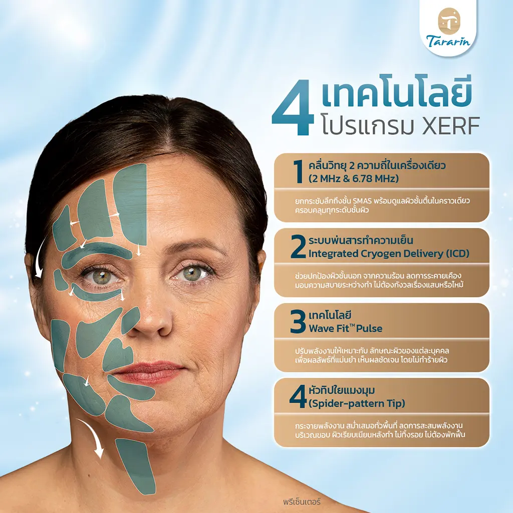 XERF เทคโนโลยียกกระชับผิวแบบ Dual-Frequency RF