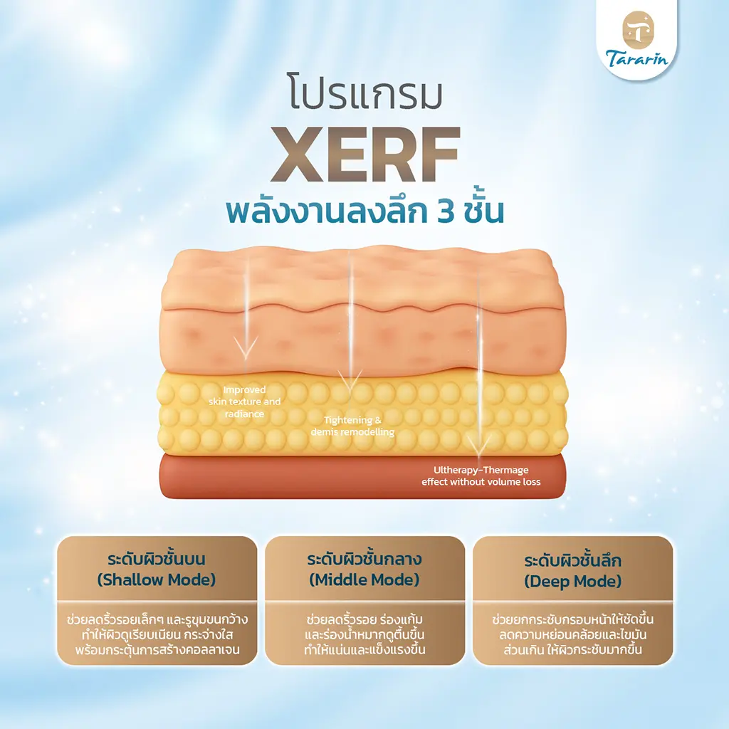 กระบวนการกระตุ้นคอลลาเจนด้วย XERF Dual-Frequency RF