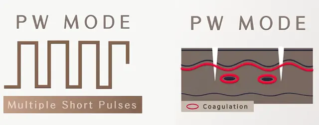 Sylfirm x Pulse Wave Mode PW รักษาฝ้า จุดด่างดำ รอยแดงสิว