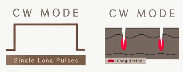 Sylfirm x Continuous Mode CW ฟื้นฟูผิว กระชับรูขุมขน รักษาหลุมสิว