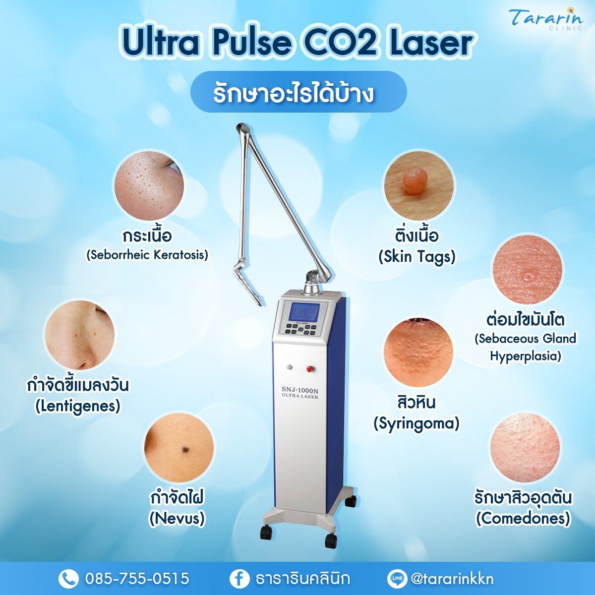 Ultra Pulse CO2 Laser รักษาได้หลายปัญหาผิวหนัง