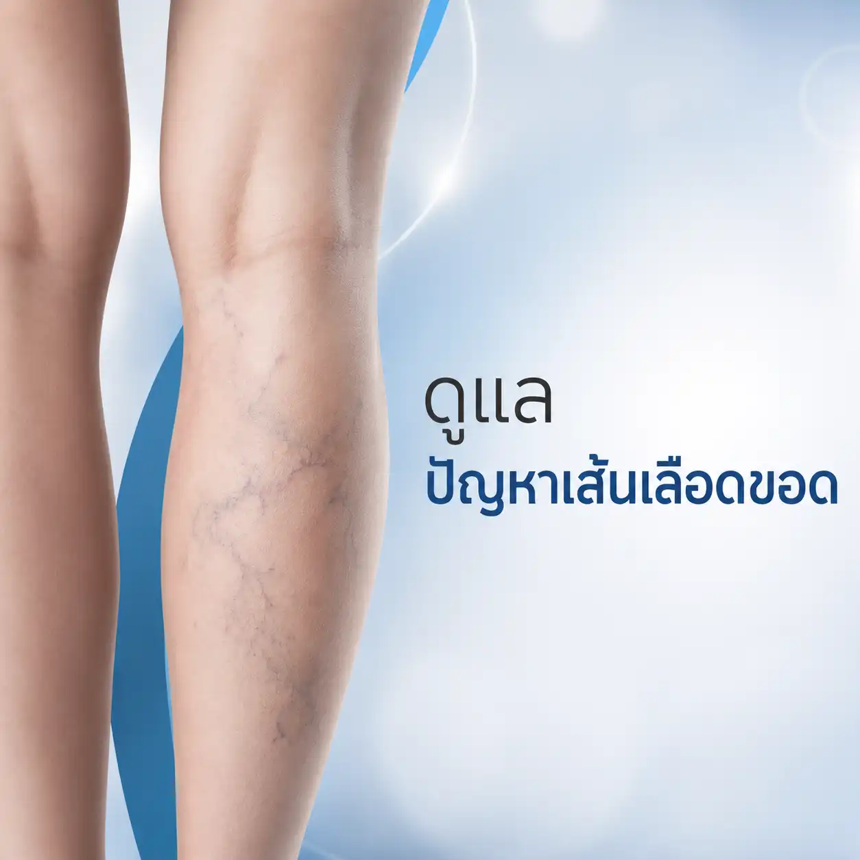 รักษาเส้นเลือดขอด VARICOSE VEIN ที่ธารารินคลินิก