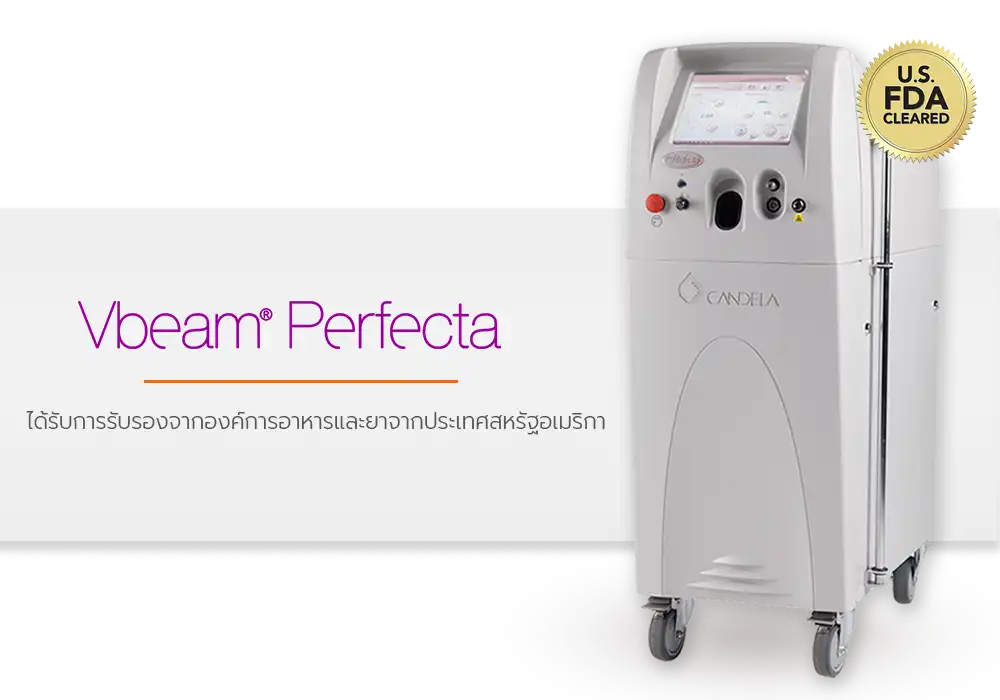 Vbeam Laser เทคโนโลยี Micro pulse PDL ส่งพลังงานอ่อนโยน
