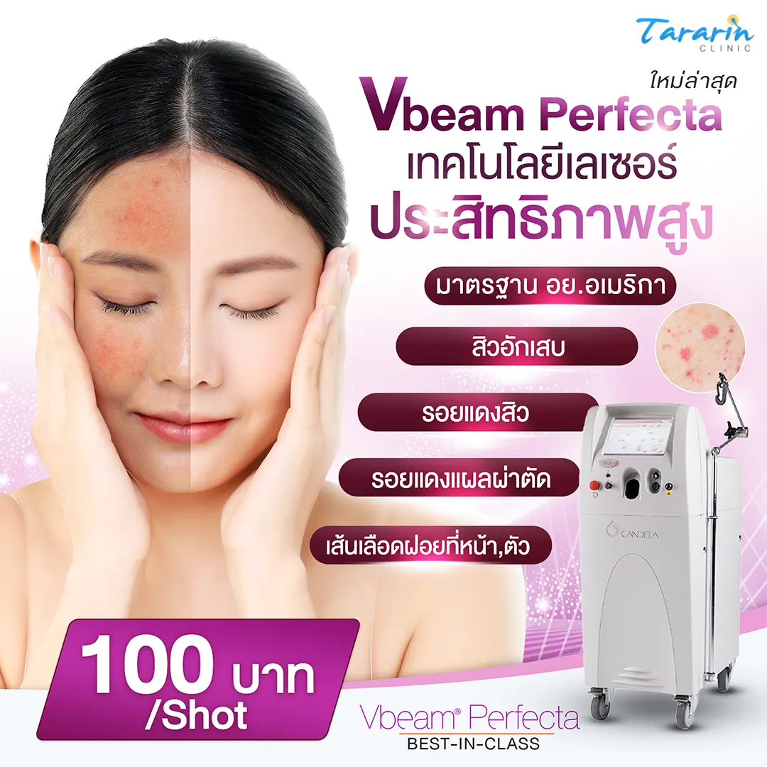 ธารารินคลินิก บริการมาตรฐานระดับสากล Vbeam Laser Perfecta
