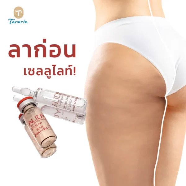 "Alidya" ฉีดลาก่อนเซลลูไลท์! นวัตกรรมใหม่ลดผิวขรุขระแบบไม่ต้องผ่าตัด