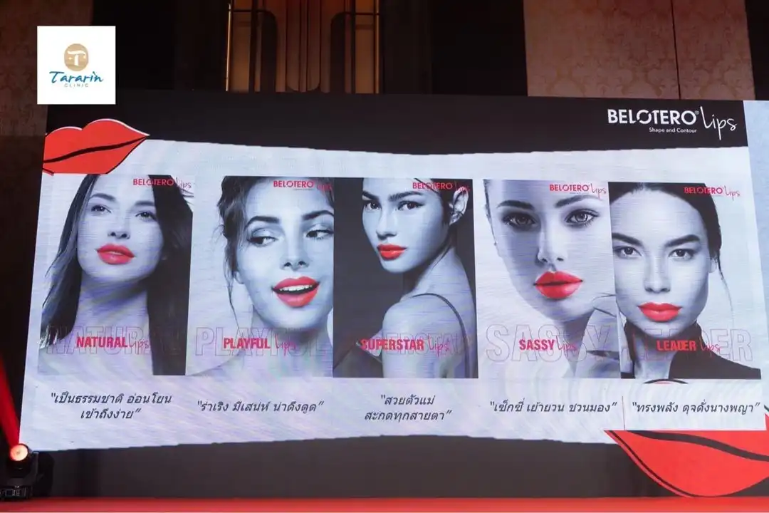 เปิดตัว Belotero Lips ฟิลเลอร์สำหรับฉีดปากโดยเฉพาะจากประเทศสวิตเซอร์แลนด์ 6