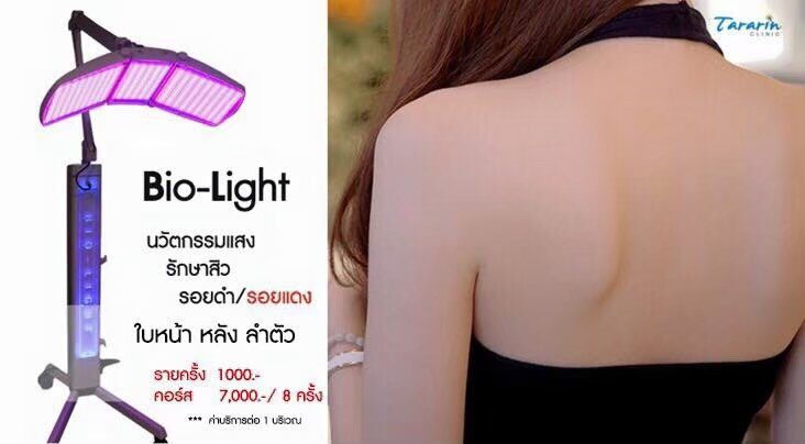 แสงรักษาสิว Bio Light Therapy