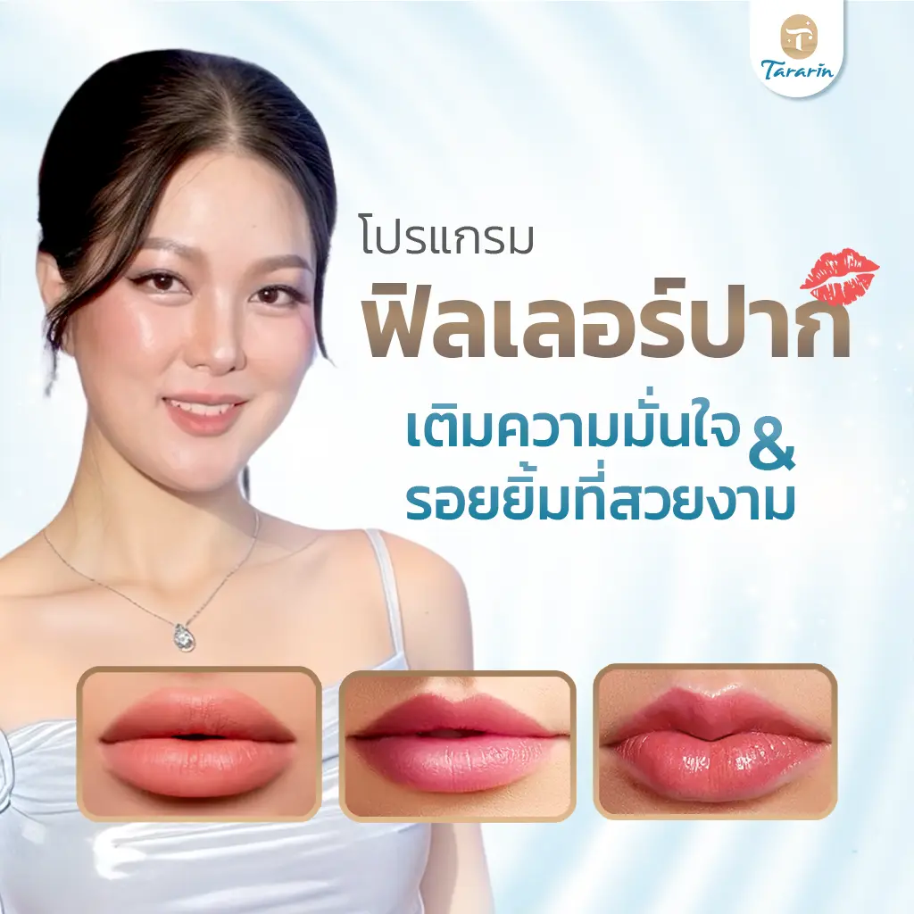 ฟิลเลอร์ปาก เติมความมั่นใจเปลี่ยนรอยยิ้มให้สวยดูเป็นธรรมชาติ