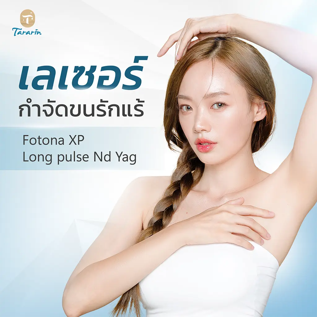 เลเซอร์กำจัดขน เลเซอร์ขนรักแร้ เลเซอร์ขนขา Long Pulse ND Yag Laser