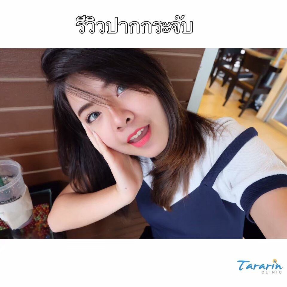 ปากกระจับ ศัลยกรรมปาก
