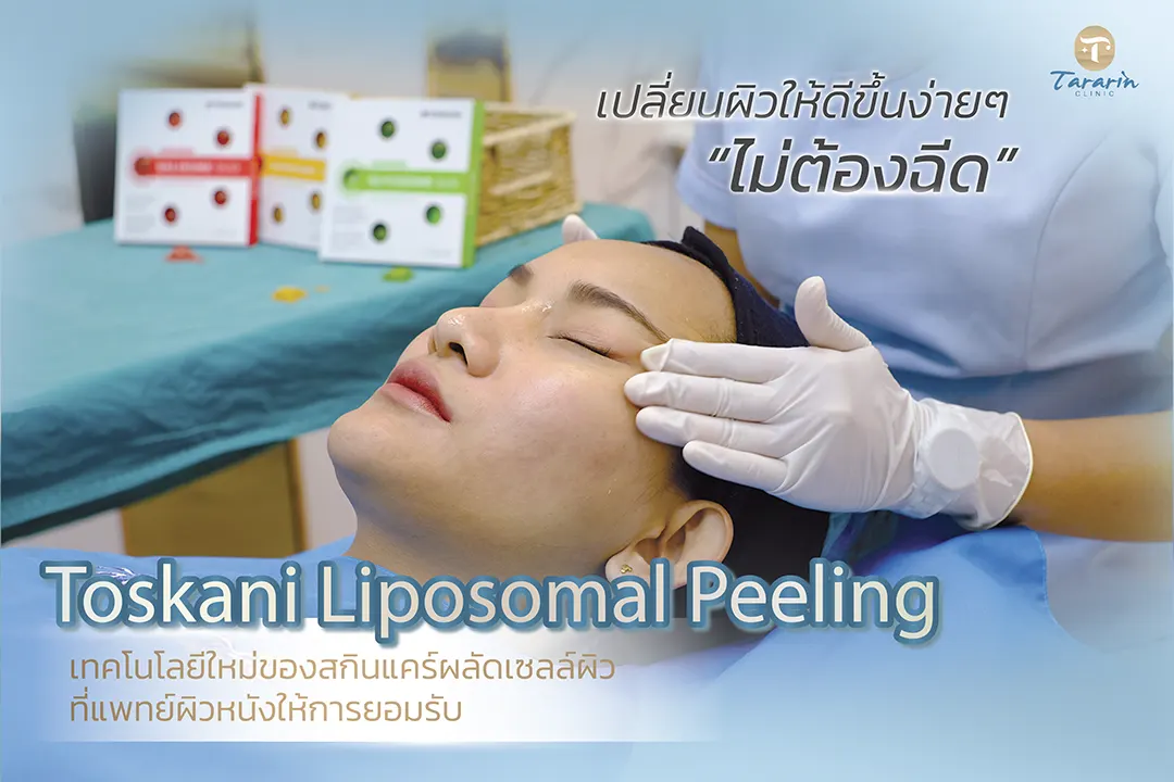 Toskani Liposomal Peeling กู้ผิว สิว ริ้วรอย