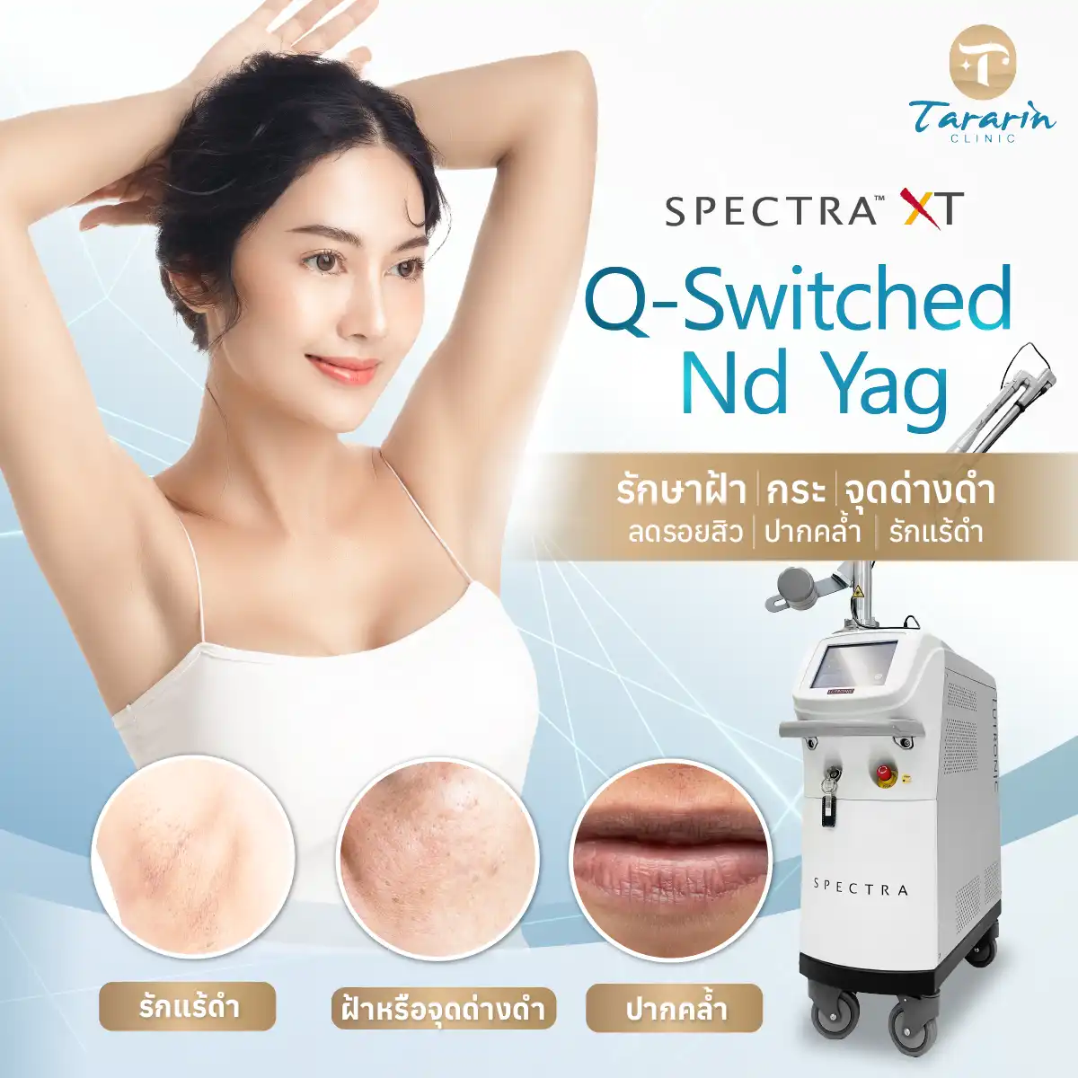 เลเซอร์รักแร้ขาว ด้วย Q Switched Nd Yag Laser