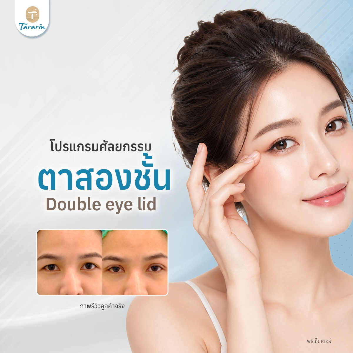 ศัลยกรรมตาสองชั้น