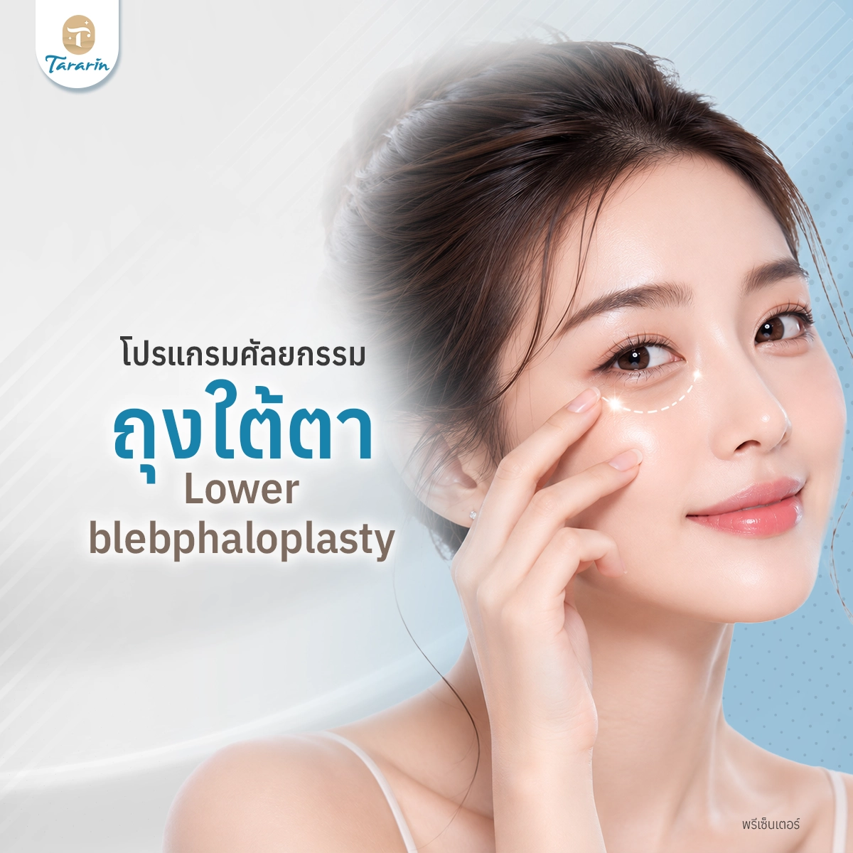 ศัลยกรรมถุงใต้ตา