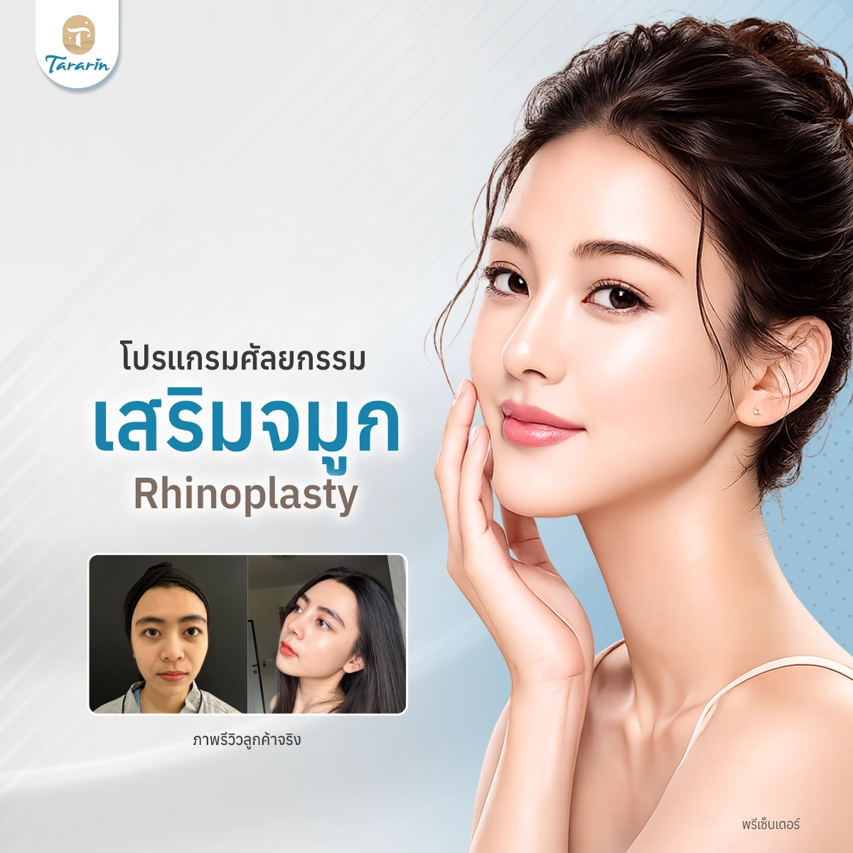 ศัลยกรรมจมูก